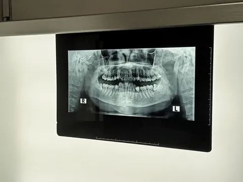 Pre-prosthetic surgery consultation at Oral Surgery Group