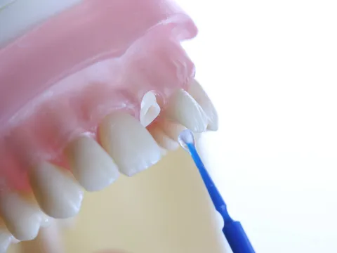 Restorative dentistry consultation