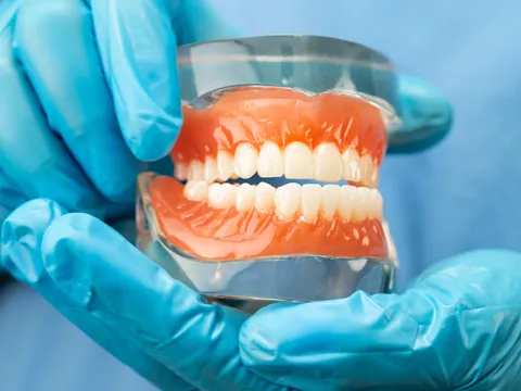 Snap-in denture implants at Oral Surgery Group